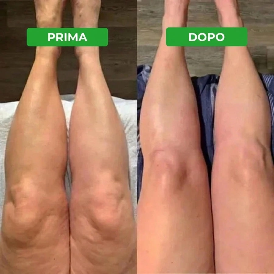 Linfia Drenante Linfatico — immagine 13