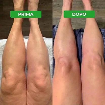 Linfia Drenante Linfatico — immagine 13